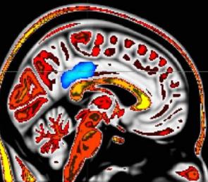 Corteza cingulada posterior-región cerebral