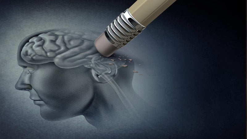 Enfermedad de Alzheimer
